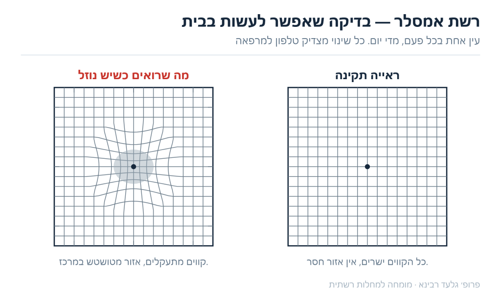 רשת אמסלר: קווים ישרים בראייה תקינה מול קווים מתעקלים ואזור מטושטש במרכז כשיש נוזל במקולה