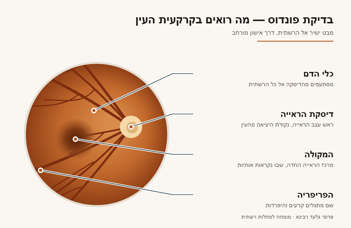איור של קרקעית העין בבדיקת פונדוס: דיסקת הראייה, המקולה, כלי הדם ופריפריית הרשתית