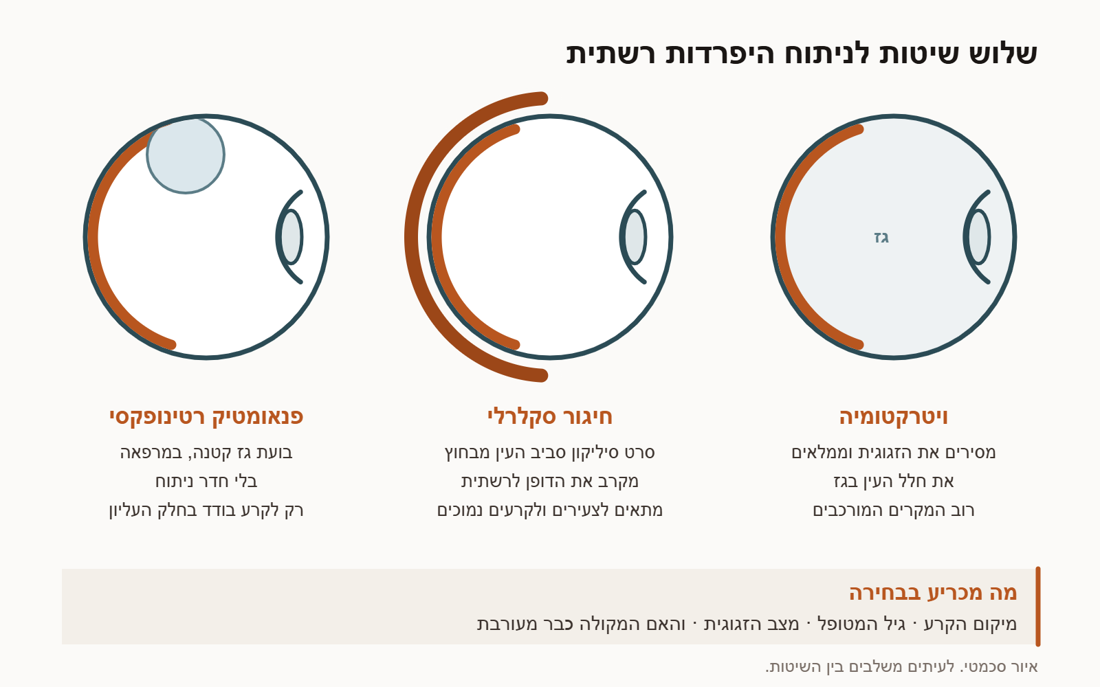 שלוש שיטות לניתוח היפרדות רשתית: ויטרקטומיה עם גז, חיגור סקלרלי ופנאומטיק רטינופקסי