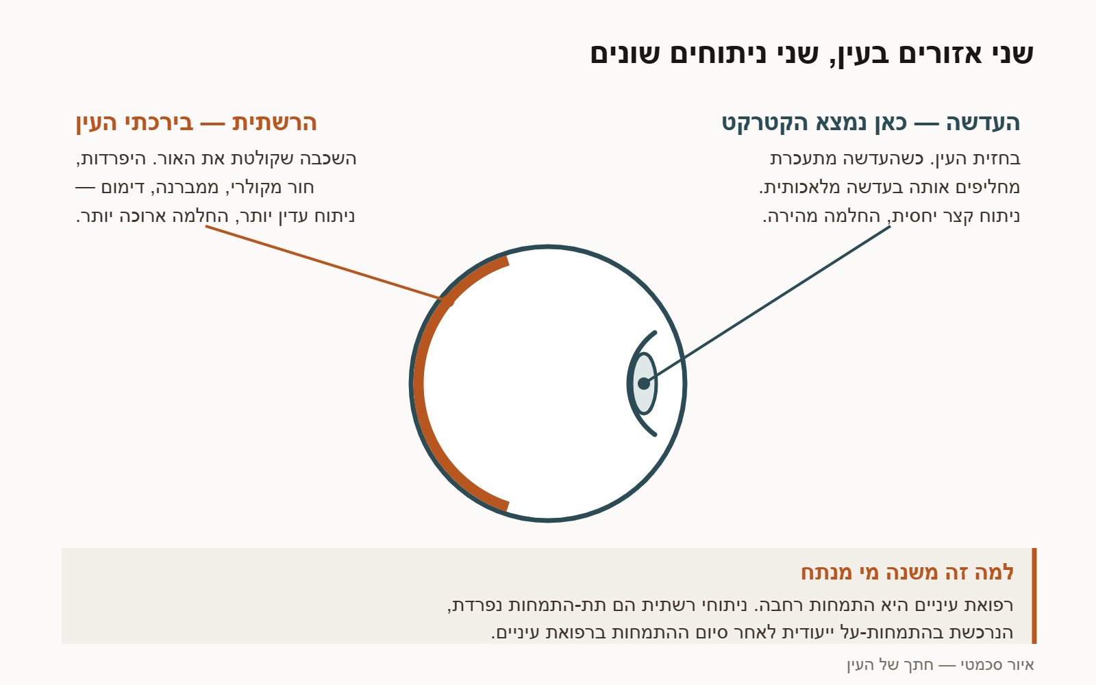 חתך סכמטי של העין: העדשה בחזית שבה נוצר הקטרקט, והרשתית בירכתי העין