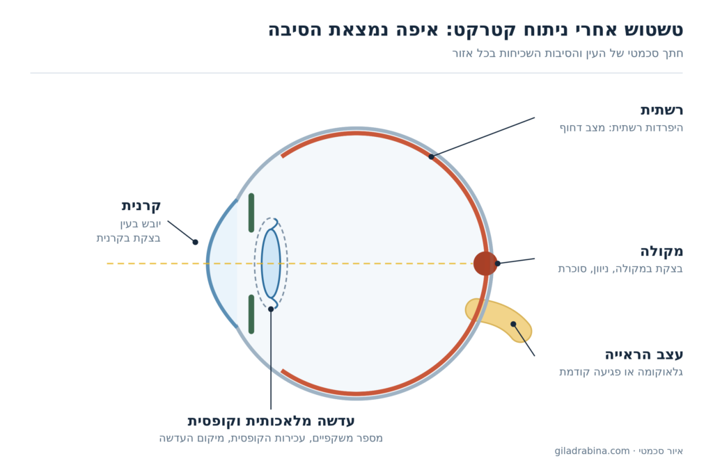 איור סכמטי של חתך העין והסיבות השכיחות לטשטוש אחרי ניתוח קטרקט