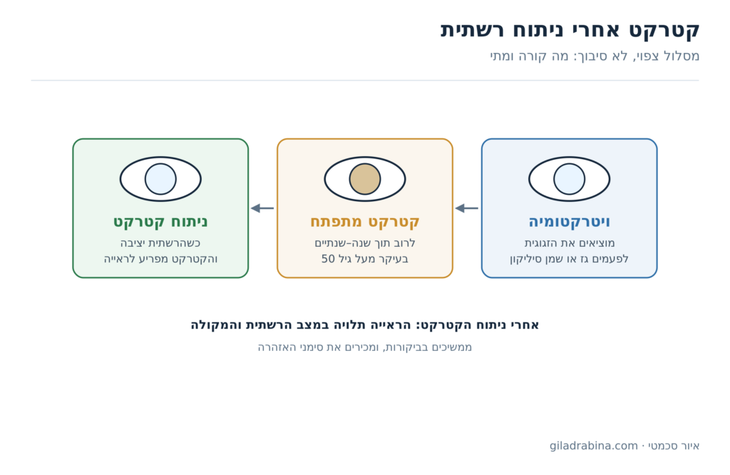תרשים: ויטרקטומיה, אחריה קטרקט מתפתח לרוב תוך שנה עד שנתיים, ואז ניתוח קטרקט כשהרשתית יציבה
