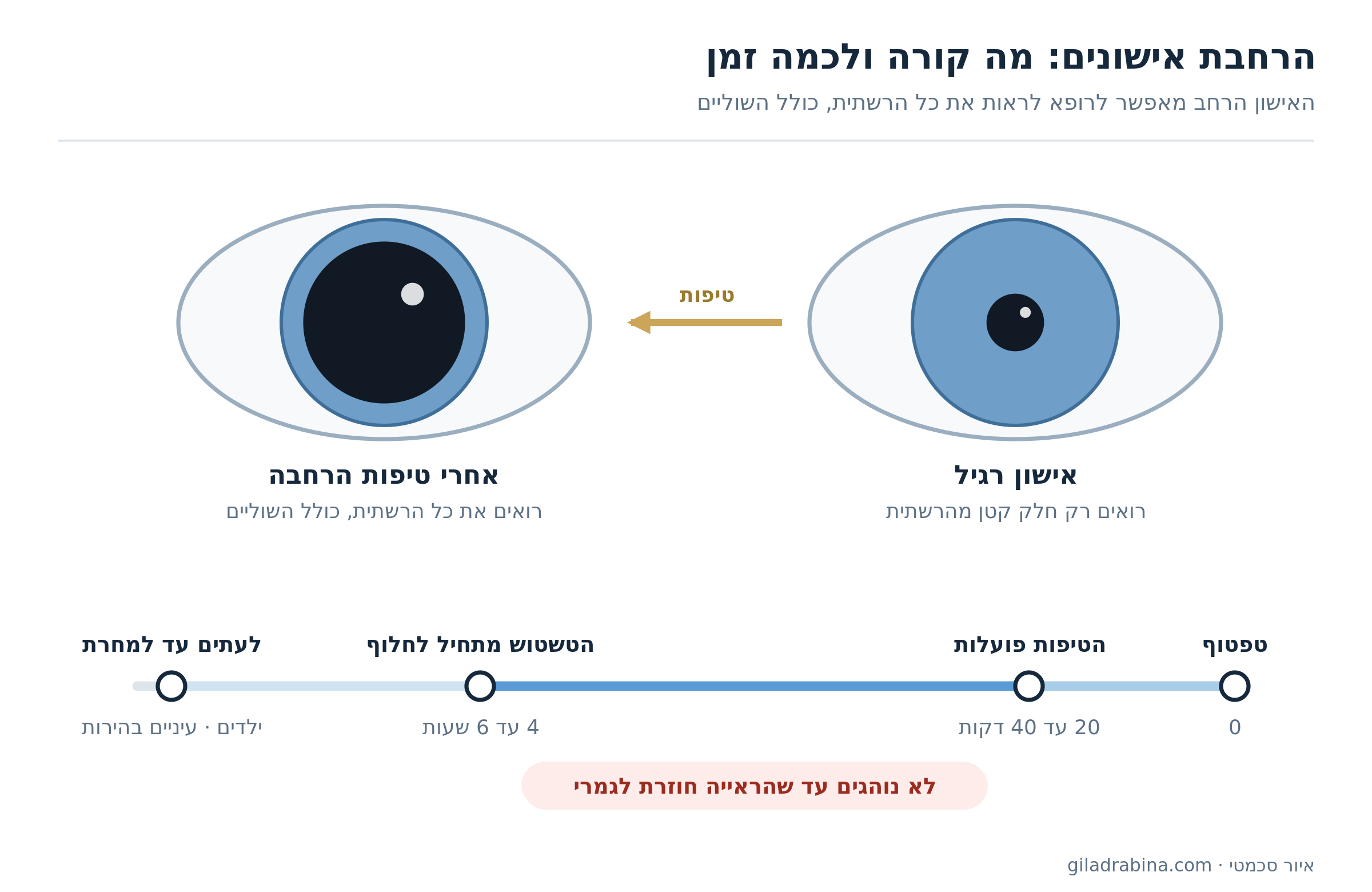 איור: אישון רגיל לעומת אישון מורחב אחרי טיפות, וציר זמן – הטיפות פועלות תוך 20 עד 40 דקות, הטשטוש חולף אחרי 4 עד 6 שעות; לא נוהגים עד שהראייה חוזרת